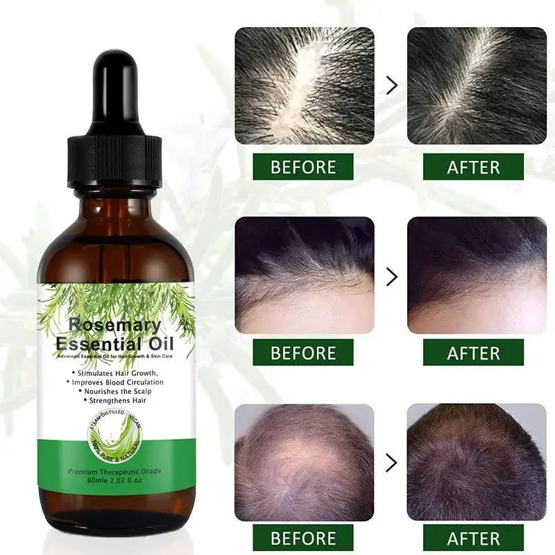 Hair Growth Bundle – Rosemary Oil + Scalp Massager | ThriveMinded - ThriveMinded & WellHaven Co